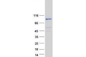 Western Blotting (WB) image for Nuclear GTPase, Germinal Center Associated (NUGGC) protein (Myc-DYKDDDDK Tag) (ABIN2714164)