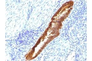 IHC testing of FFPE human endometrium with ASRGL1 antibody (clone CRASH/1289). (ASRGL1 抗体)