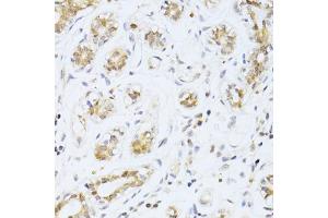 Immunohistochemistry (IHC) image for anti-Ets Variant 1 (ETV1) (AA 80-300) antibody (ABIN6140327)