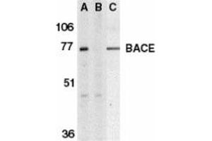 Image no. 1 for anti-Beta-secretase 1 (BACE1) (C-Term) antibody (ABIN204488) (BACE1 抗体  (C-Term))