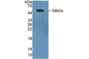 Detection of Recombinant PDCD6IP, Human using Polyclonal Antibody to Programmed Cell Death Protein 6 Interacting Protein (PDCD6IP) (ALIX 抗体  (AA 174-383))