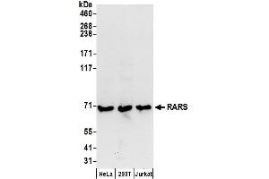 Western Blotting (WB) image for anti-Arginyl-tRNA Synthetase (RARS) (AA 1-50) antibody (ABIN7450637)
