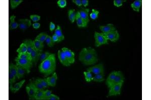 Immunofluorescence staining of HepG2 cells with ABIN7171984 at 1:166, counter-stained with DAPI. (SLC19A3 抗体  (AA 191-282))