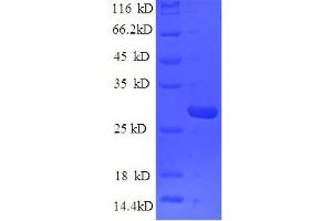 SDS-PAGE (SDS) image for Mannose-Binding Lectin (Protein C) 2, Soluble (MBL2) (AA 21-248) protein (His tag) (ABIN5713636) (MBL2 Protein (AA 21-248) (His tag))