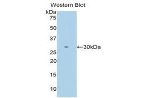 Detection of Recombinant ITLN1, Mouse using Polyclonal Antibody to Intelectin 1 (ITLN1) (ITLN1/Omentin 抗体  (AA 28-270))