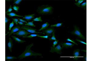 Immunofluorescence of purified MaxPab antibody to NMI on HeLa cell. (NMI 抗体  (AA 1-307))