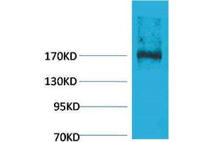 Western Blotting (WB) image for anti-Ectopic P-Granules Autophagy Protein 5 Homolog (EPG5) antibody (ABIN3181523) (EPG5 抗体)