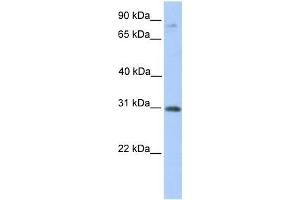 Human Placenta; WB Suggested Anti-ABHD13 Antibody Titration: 0.