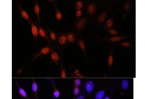 Immunofluorescence analysis of NIH/3T3 cells using KAT6A Polyclonal Antibody at dilution of 1:100. (MYST3 抗体)