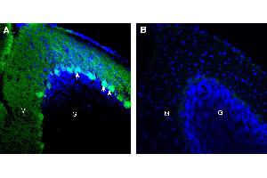 Expression of CD38 in mouse cerebellum. (CD38 抗体  (Extracellular))
