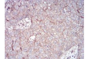 Immunohistochemistry (IHC) image for anti-Ras-related Protein Ral-A (rala) (AA 71-203) antibody (ABIN5542386)
