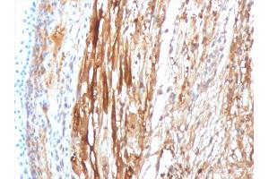 Immunohistochemistry (IHC) image for anti-Crystallin, alpha B (CRYAB) antibody (ABIN6939187)