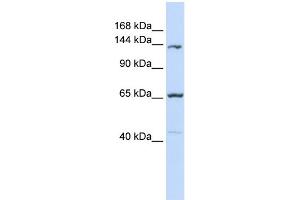 WB Suggested Anti-PCDH12 Antibody Titration:  0. (PCDH12 抗体  (Middle Region))
