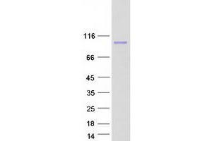 Forkhead Box P2 (FOXP2) (Transcript Variant 1) protein (Myc-DYKDDDDK Tag)