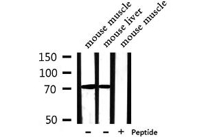 Western blot analysis of extracts from mouse muscle,mouse liver, using PABPC4 Antibody. (PABPC4 抗体  (Internal Region))