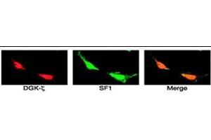 SF1 colocalizes with DGK and  in the nuclei of H295R cells. (DGKZ 抗体  (C-Term))