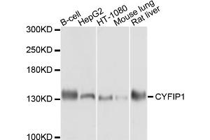 Western blot analysis of extracts of various cell lines, using CYFIP1 antibody. (CYFIP1 抗体)