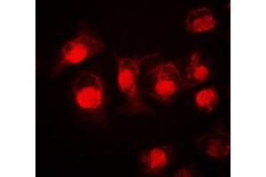 Immunofluorescent analysis of STAT3 staining in A549 cells. (STAT3 抗体  (C-Term))