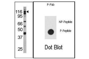 Image no. 1 for anti-Colony Stimulating Factor 2 Receptor, Beta (CSF2RB) (pTyr766) antibody (ABIN358147) (CD131 抗体  (pTyr766))