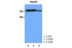 Image no. 1 for anti-phosphofructokinase, Muscle (PFKM) (AA 1-780), (N-Term) antibody (ABIN1449415) (PFKM 抗体  (N-Term))