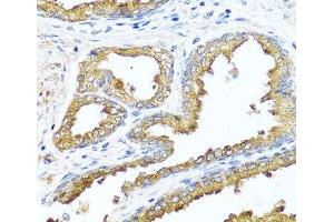 Immunohistochemistry of paraffin-embedded Human prostate using NCK2 Polyclonal Antibody at dilution of 1:100 (40x lens). (NCK2 抗体)