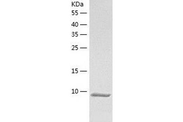 TSC1 Protein (AA 24-94) (His tag)