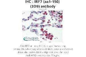 Image no. 2 for anti-Interferon Regulatory Factor 7 (IRF7) (AA 1-150) antibody (ABIN1723206) (IRF7 抗体  (AA 1-150))