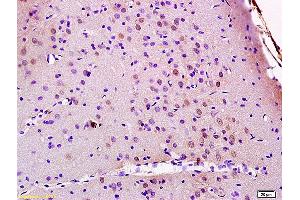 Formalin-fixed and paraffin embedded rat brain labeled with Anti JMY Polyclonal Antibody, Unconjugated (ABIN872348) at 1:200 followed by conjugation to the secondary antibody and DAB staining