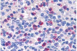 Human Spleen: Formalin-Fixed, Paraffin-Embedded (FFPE) (PGLYRP1 抗体  (AA 179-189))