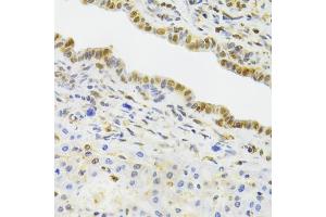 Immunohistochemistry of paraffin-embedded rat liver using EFTUD2 Antibody (ABIN5974236) at dilution of 1/100 (40x lens). (EFTUD2 抗体)