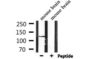 Western Blotting (WB) image for anti-Catenin (Cadherin-Associated Protein), delta 2 (Neural Plakophilin-Related Arm-Repeat Protein (CTNND2) (C-Term) antibody (ABIN6261097)