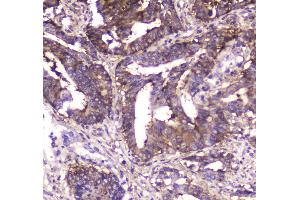 IHC analysis of MVP using anti-MVP antibody . (MVP 抗体  (AA 2-259))