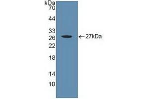 Detection of Recombinant CYR61, Human using Polyclonal Antibody to Cysteine Rich Protein, Angiogenic Inducer 61 (CYR61) (CYR61 抗体  (AA 178-381))