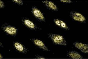 Immunofluorescence staining of Human Endothelial cells. (POLD1 抗体  (AA 60-261))