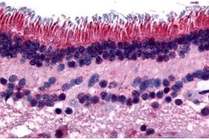 Human Retina (formalin-fixed, paraffin-embedded) stained with PTPRM antibody ABIN297531 at 16 ug/ml followed by biotinylated goat anti-rabbit IgG secondary antibody ABIN481713, alkaline phosphatase-streptavidin and chromogen. (PTPRM 抗体  (Internal Region))