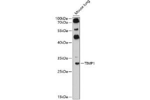 Immunofluorescence analysis of HeLa cells using TIMP1 antibody (ABIN6128284, ABIN6149176, ABIN6149177 and ABIN6218052) at dilution of 1:100. (TIMP1 抗体  (AA 24-207))