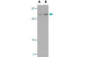 Western blot analysis of PIGY in human spleen tissue lysate with PIGY polyclonal antibody  at (A) 1 and (B) 2 ug/mL . (PIGY 抗体  (Internal Region))