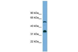 CYP26B1 antibody used at 1 ug/ml to detect target protein. (CYP26B1 抗体  (Middle Region))