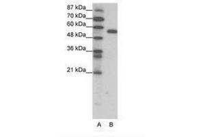 Image no. 1 for anti-Forkhead Box C2 (MFH-1, Mesenchyme Forkhead 1) (FOXC2) (AA 412-461) antibody (ABIN202668) (FOXC2 抗体  (AA 412-461))