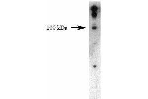 Western blot analysis of Dynamin II on a HeLa cell lysate (Human cervical epitheloid carcinoma, ATCC CCL-2) using 1 µg/mL of the Mouse Anti-Dynamin II antibody. (DNM2 抗体  (AA 274-555))