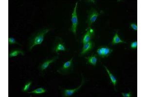 Immunofluorescence staining of U251 cells with ABIN7159457 at 1:66, counter-stained with DAPI. (Cyclin M3 抗体  (AA 358-645))