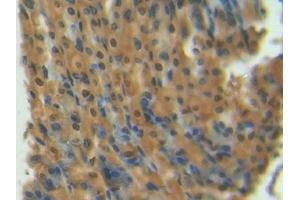 Detection of S100 in Mouse Stomach Tissue using Polyclonal Antibody to S100 Calcium Binding Protein (S100)