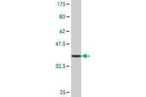 Western Blot detection against Immunogen (35. (KDM5B 抗体  (AA 231-319))