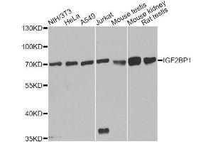 Western blot analysis of extracts of various cell lines, using IGF2BP1 antibody. (IGF2BP1 抗体  (C-Term))