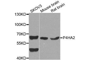 Western blot analysis of extracts of various cell lines, using P4HA2 antibody. (P4HA2 抗体  (AA 234-533))
