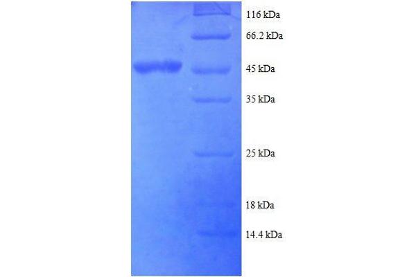 ADAR Protein (AA 1-176, partial) (His-SUMO Tag)