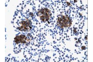 Image no. 1 for anti-Zinc Finger Protein 182 (ZNF182) (AA 543-592) antibody (ABIN6735968) (ZNF182 抗体  (AA 543-592))