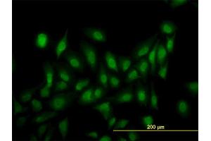 Immunofluorescence of monoclonal antibody to LRRFIP1 on HeLa cell.