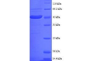 SDS-PAGE (SDS) image for Ubiquitin-Conjugating Enzyme E2I (UBE2I) (AA 1-157), (partial) protein (GST tag) (ABIN5712061) (UBE2I Protein (AA 1-157, partial) (GST tag))