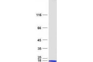 Western Blotting (WB) image for Nucleoside diphosphate kinase B (NME2) (Transcript Variant 4) protein (Myc-DYKDDDDK Tag) (ABIN2726977)